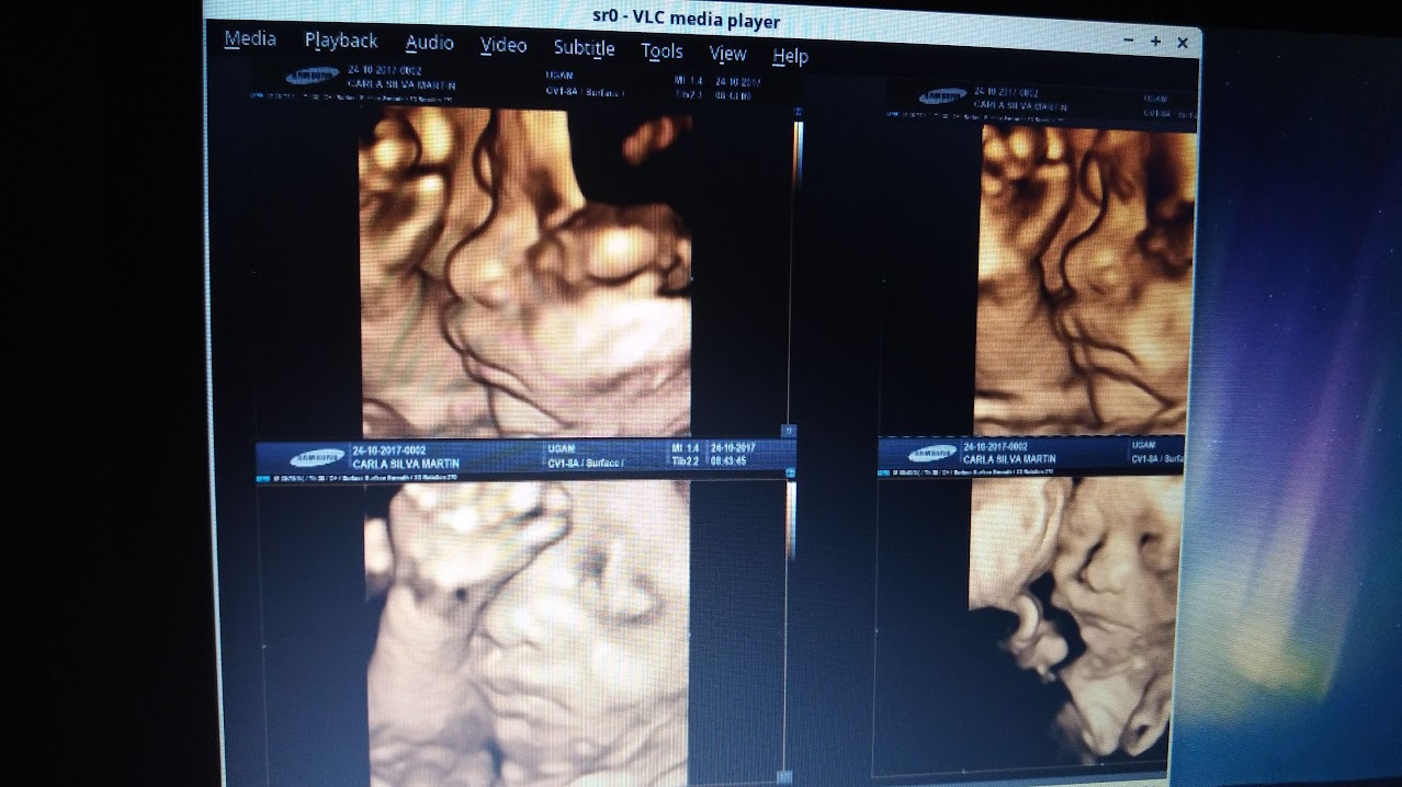 Ultrassom do rostinho